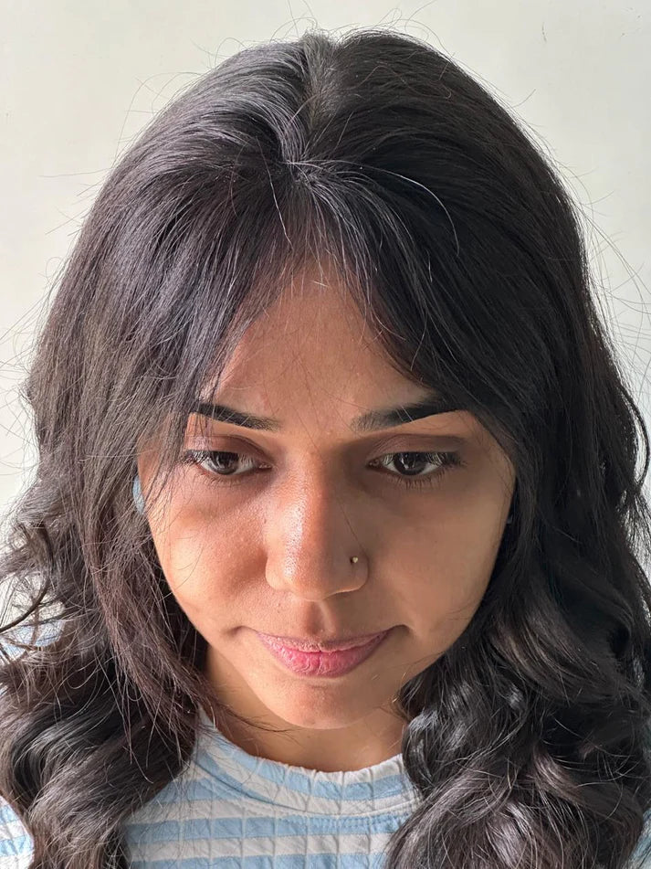 FRONT HAIRLINE PATCH