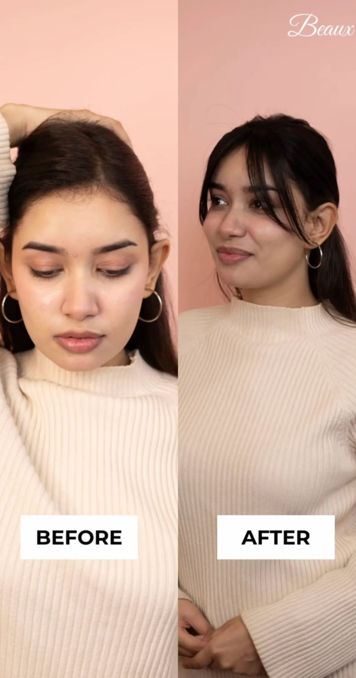 Forehead Frontline Hair Patch